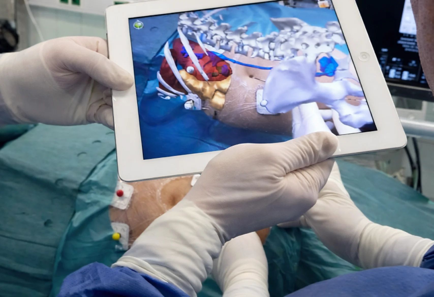 AR IN HEALTHCARE